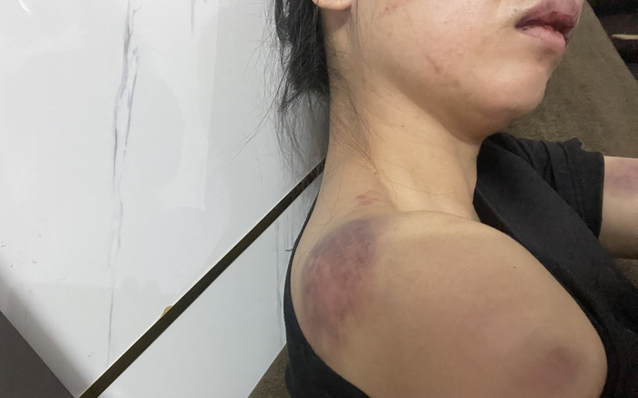 chong tra tan vo 1 chong tra tan vo 1