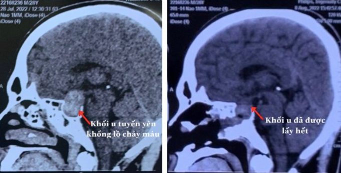tin tuc doi song 21 8