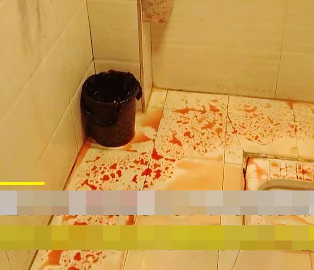 voi nuoc chay ra do nhu mau 2