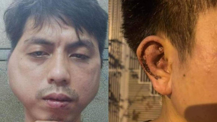 nhan vien bi chu quan lau danh bien dang khuon mat thuong tich 7 nhan vien bi chu quan lau danh bien dang khuon mat thuong tich 7