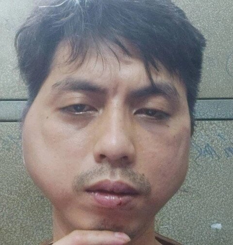 khoi to vu nhan vien bi chu quan lau danh bien dang khuon mat khoi to vu nhan vien bi chu quan lau danh bien dang khuon mat
