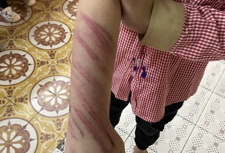 vu hoc sinh lop 2 nghi bi ban trai cua me bao hanh nha truong thong tin vu hoc sinh lop 2 nghi bi ban trai cua me bao hanh nha truong thong tin