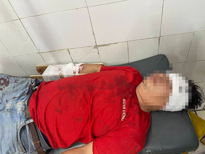 vu nguoi dan ong bi chem gan dut lia canh tay o tp thu duc trieu tap mot so doi tuong vu nguoi dan ong bi chem gan dut lia canh tay o tp thu duc trieu tap mot so doi tuong