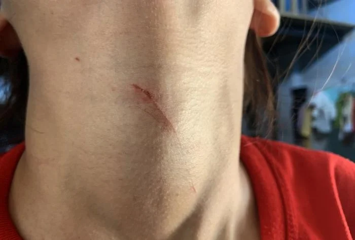 vu co gai 17 tuoi bi di dao ep vao nha ve sinh roi cuop bong tai danh tinh nghi pham vu co gai 17 tuoi bi di dao ep vao nha ve sinh roi cuop bong tai danh tinh nghi pham