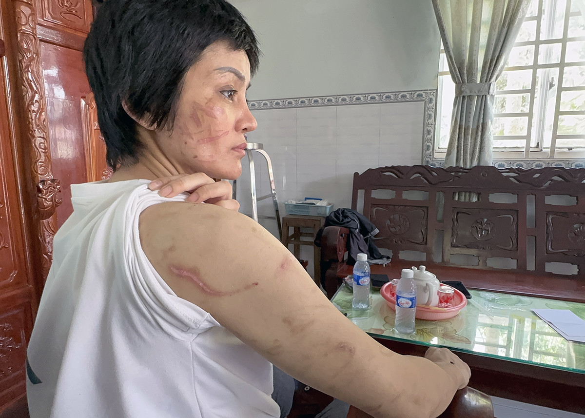 thong tin nong vu vo mang bau 7 thang to chong troi tay chan danh dap da man thong tin nong vu vo mang bau 7 thang to chong troi tay chan danh dap da man