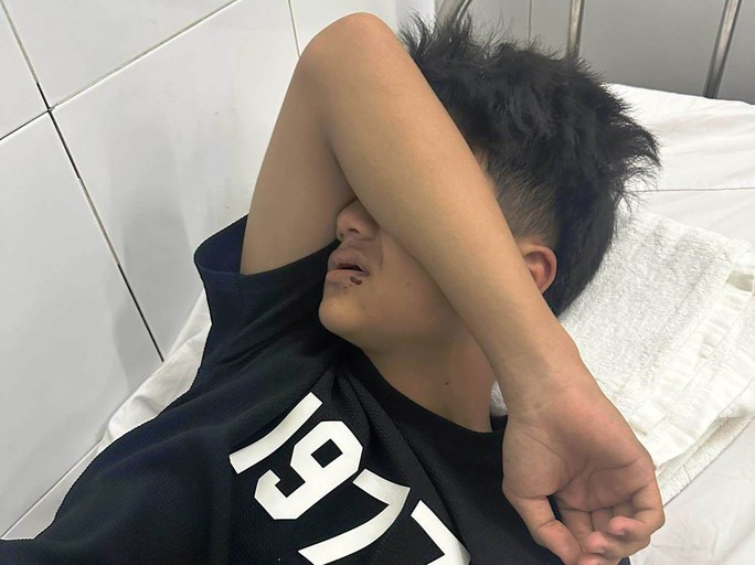 di tam bien nam sinh o da nang bi nguoi la danh gay 4 rang