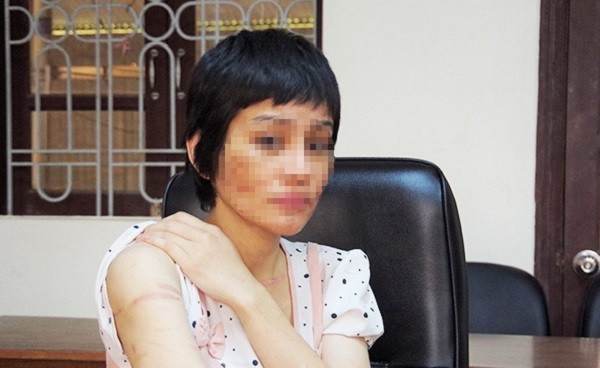 vu nguoi vo mang thai 7 thang bi chong bao hanh o hai duong nguoi chong doi dien voi hinh phat gi 2 vu nguoi vo mang thai 7 thang bi chong bao hanh o hai duong nguoi chong doi dien voi hinh phat gi 2