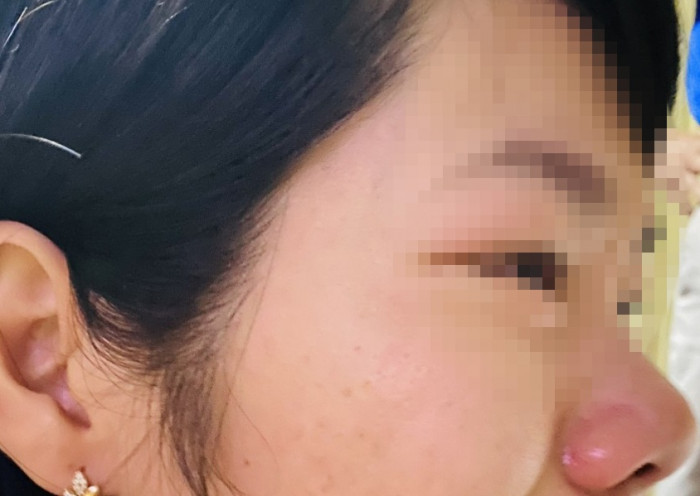 dak nong con bi hanh kiem trung binh phu huynh den nha hanh hung co giao dak nong con bi hanh kiem trung binh phu huynh den nha hanh hung co giao