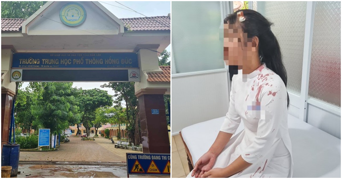 xac minh vu nu sinh lop 10 bi danh chan thuong dau trong gio ra choi 9 9 xac minh vu nu sinh lop 10 bi danh chan thuong dau trong gio ra choi 9 9