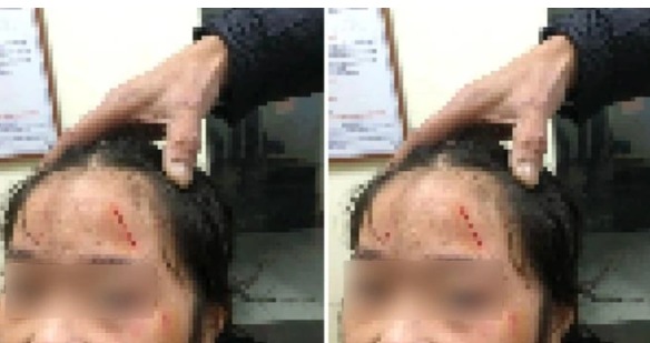 dien bien moi nhat vu nu sinh lop 6 bi ban hanh hung o ha noi