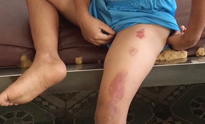 vu be trai 6 tuoi bi cha duong cham thuoc la vao nguoi he lo loi khai gay soc 
