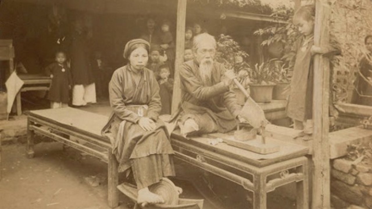chuyen it biet ve dich benh o viet nam xua dich benh va cai duoi con chuot