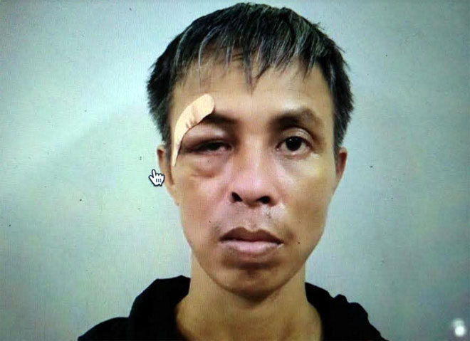 vu dam nhieu nhat vao benh nhan cung phong o ha noi nghi pham khai gi vu dam nhieu nhat vao benh nhan cung phong o ha noi nghi pham khai gi