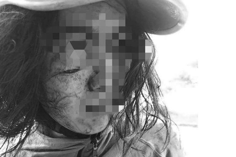vu co gai 22 tuoi bi rach mat luc di photo giay to ly hon lo dien nghi pham bat ngo vu co gai 22 tuoi bi rach mat luc di photo giay to ly hon lo dien nghi pham bat ngo