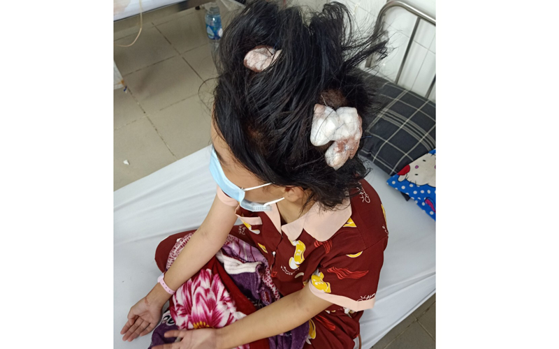 vu be gai 16 tuoi bi cha duong dung tuyp sat danh bat tinh dien bien moi nhat vu be gai 16 tuoi bi cha duong dung tuyp sat danh bat tinh dien bien moi nhat