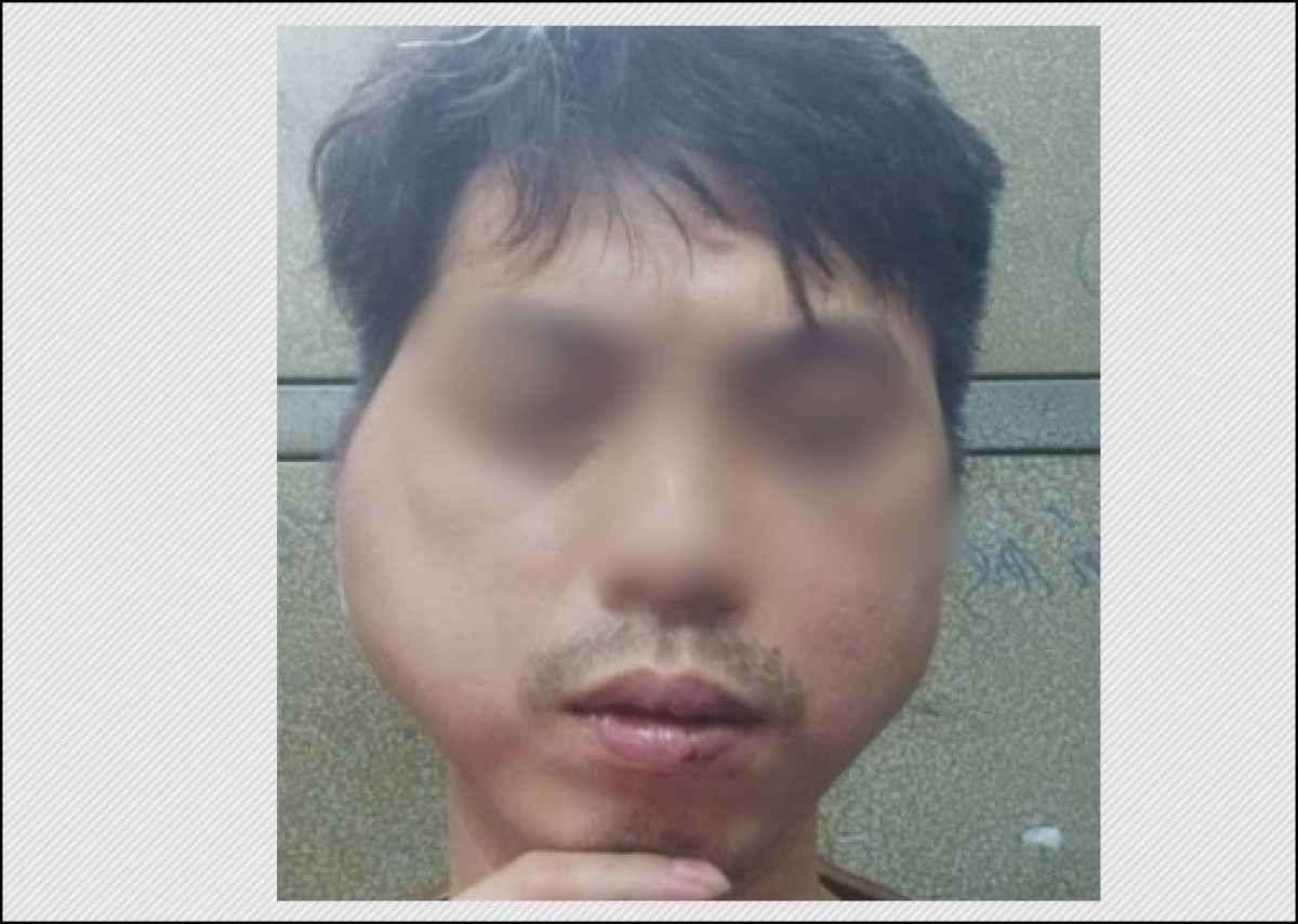 thanh nien 29 tuoi to bi chu quan lau nuong o ha noi danh bien dang khuon mat thanh nien 29 tuoi to bi chu quan lau nuong o ha noi danh bien dang khuon mat