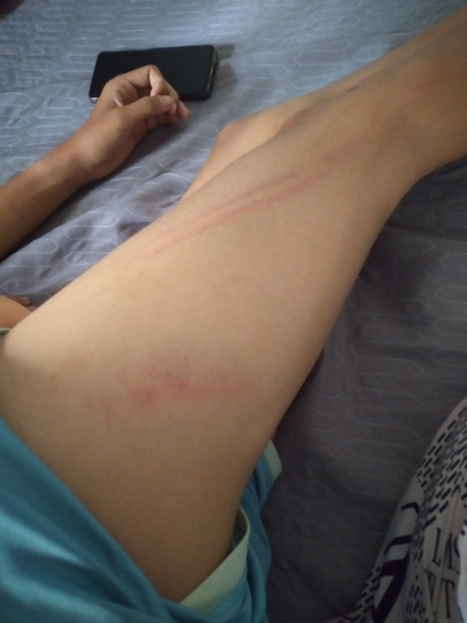 xac minh vu nam sinh lop 9 vo co bi danh gay tay 3