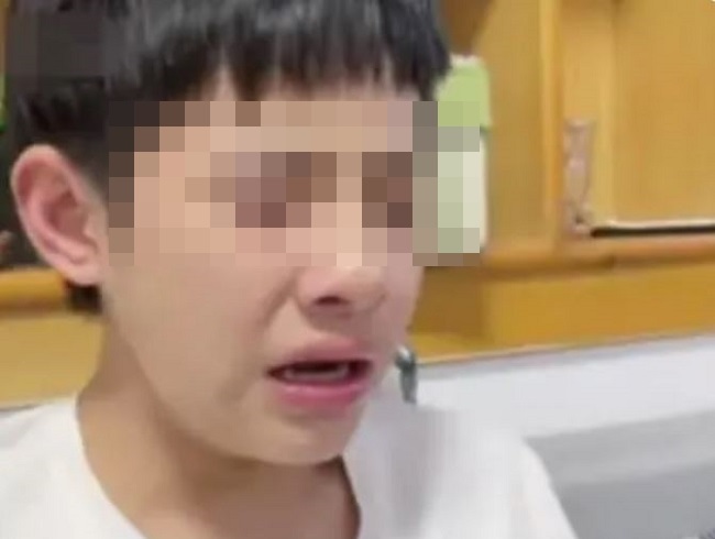 nam sinh vien nam nhat bi buoc thoi hoc sau 5 ngay den truong vi benh mu mau gay tranh cai 01