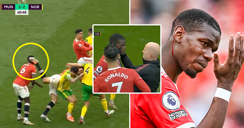 pogba phat dien vi bi harry maguire da rach dau 02 pogba phat dien vi bi harry maguire da rach dau 02