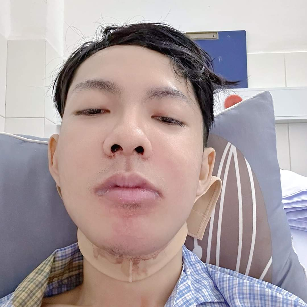 hot tiktoker vo thanh y choi lon chi 200 trieu de trung tu nhan sac tai adona 04 hot tiktoker vo thanh y choi lon chi 200 trieu de trung tu nhan sac tai adona 04