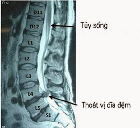 image1 image1