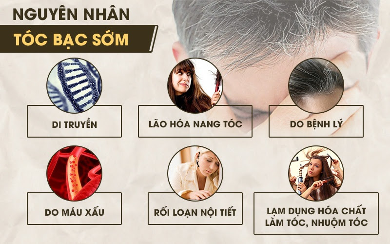 nguyen nhan khien toc bac som va cach chua tri 11