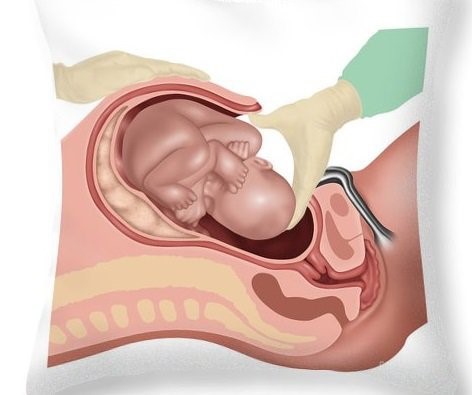 mo lay thai chu dong 1 mo lay thai chu dong 1