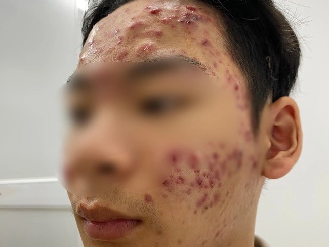 viem da 1705664018567634980425