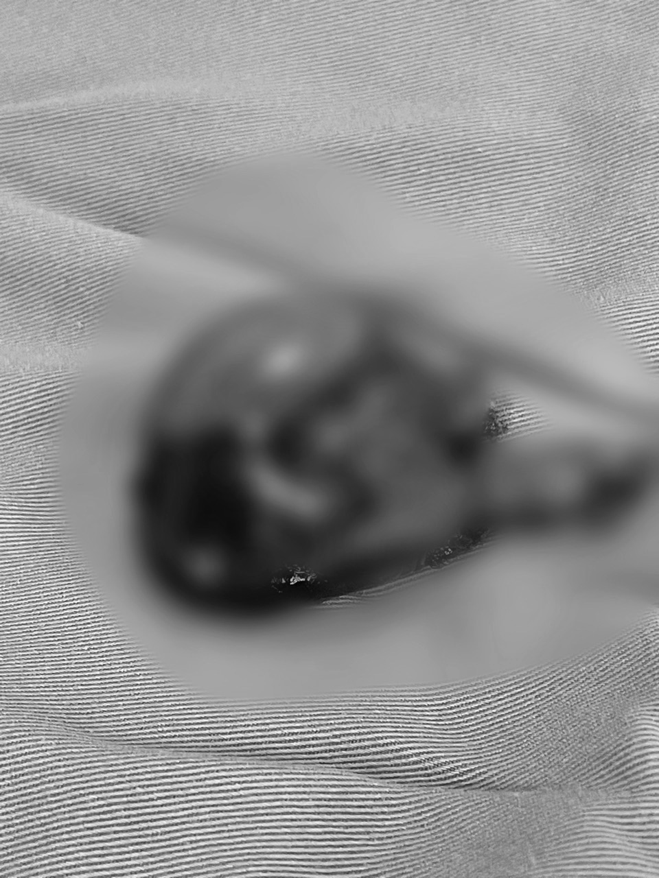 thieu nien dot nhien dau vung ha bo nhung giau bo me den vien phai cat bo tinh hoan thieu nien dot nhien dau vung ha bo nhung giau bo me den vien phai cat bo tinh hoan