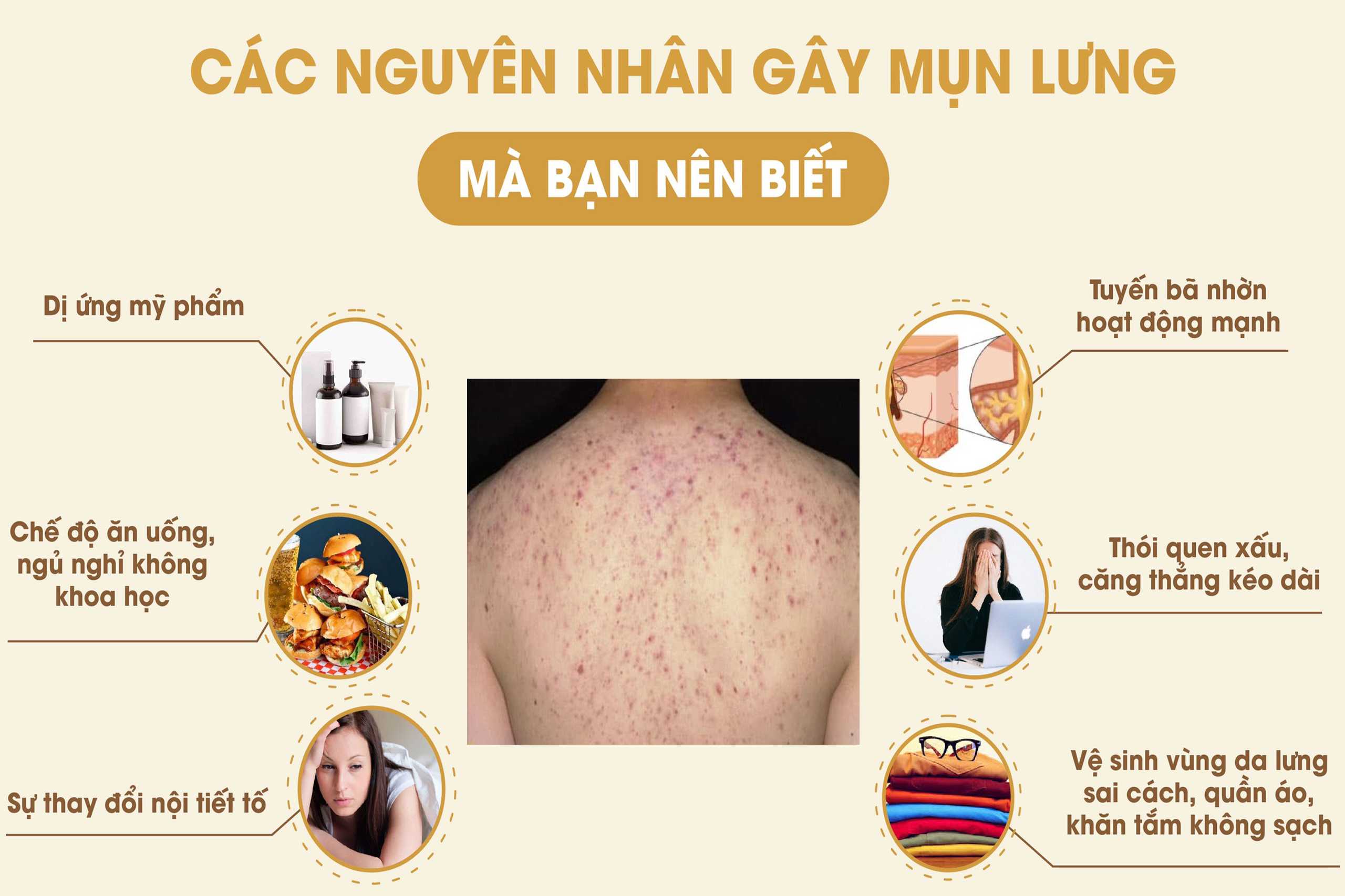 nguyen nhan gay mun nguyen nhan gay mun