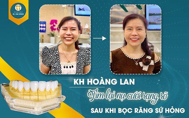 anh 3dang anh 3dang