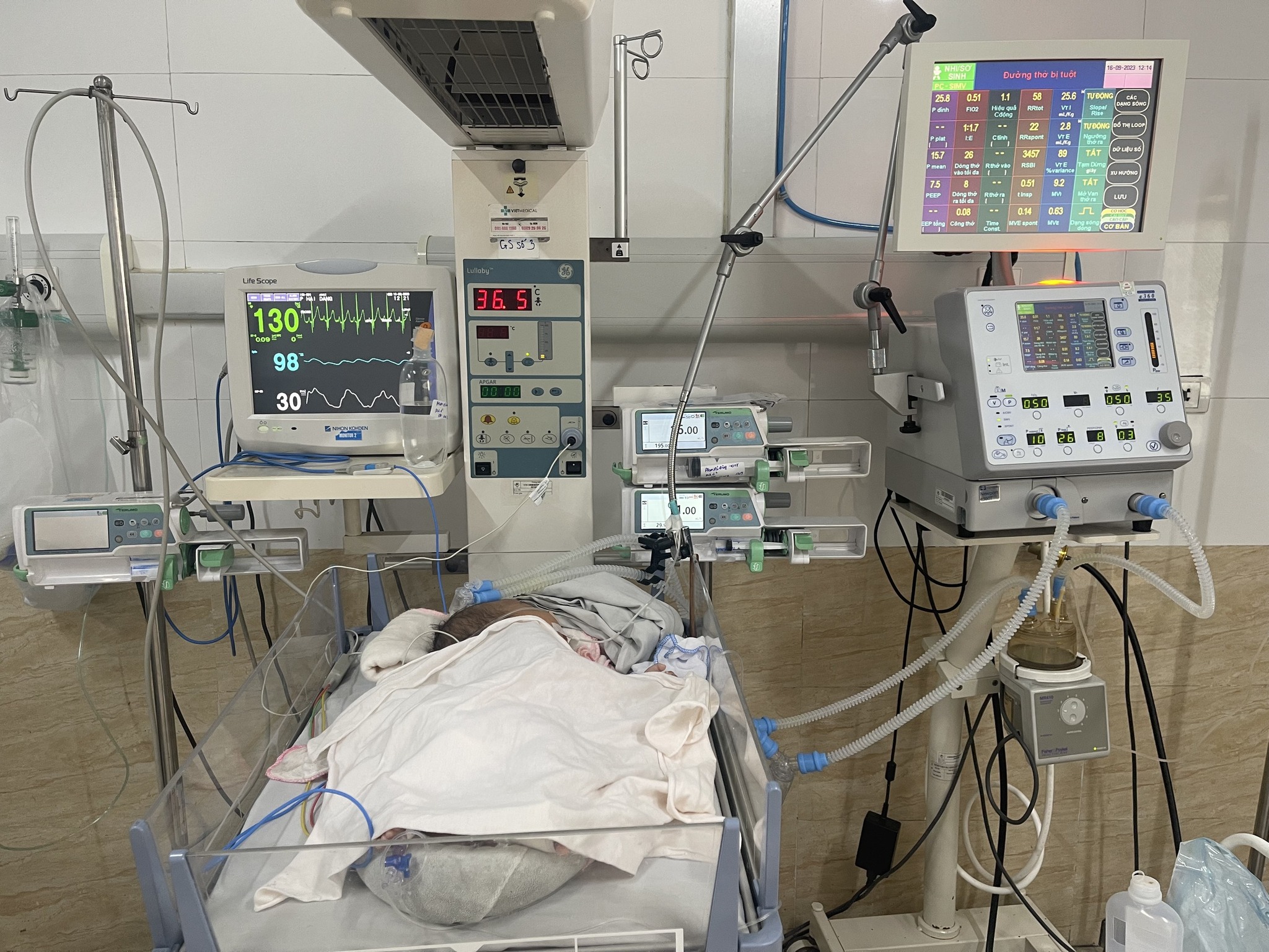 benh nhi 39 ngay tuoi nhiem virus rsv lay qua nu hon 2