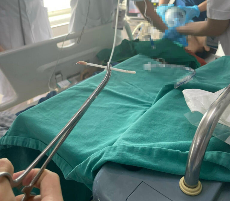 nguy kich do tam bong ngoay tai mac o khi quan 2