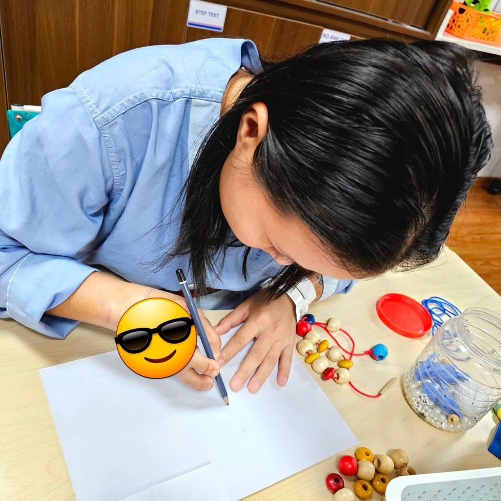 tao hinh 2 ngon chan thanh 2 ngon tay cho nguoi phu nu bi tai nan mat ngon 2 tao hinh 2 ngon chan thanh 2 ngon tay cho nguoi phu nu bi tai nan mat ngon 2