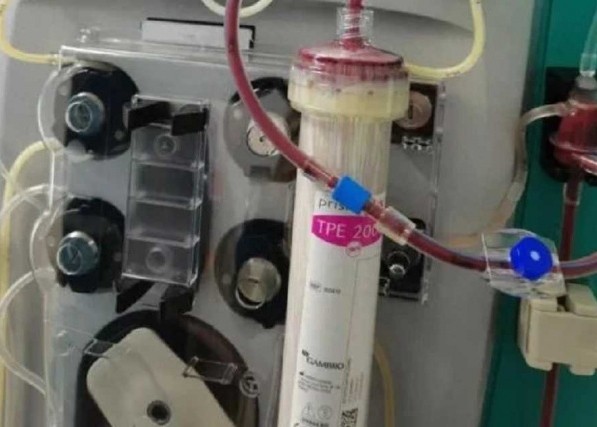 lien tuc an trua voi ga ran huyet tuong chang trai chuyen mau sua dspl