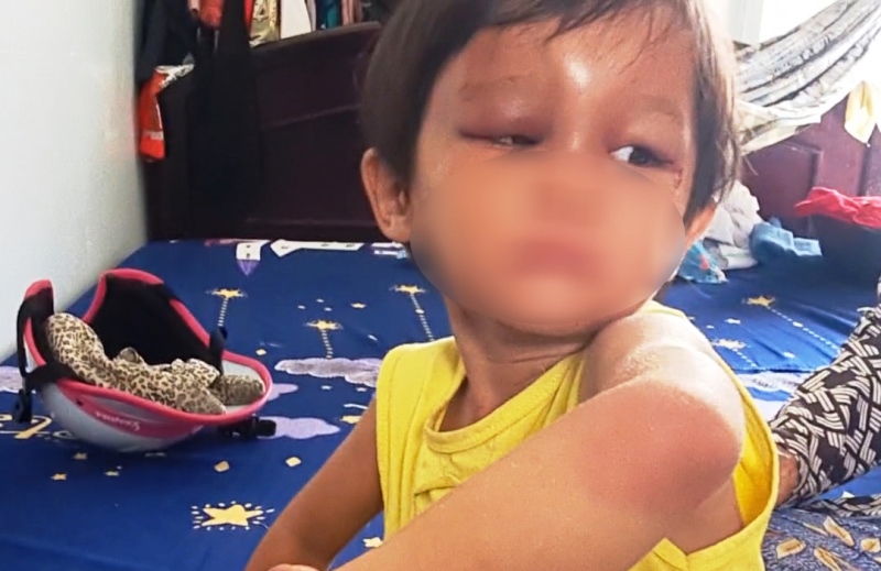 tin nong 24h hom nay ngay 8 11 2023 be gai 4 tuoi bi cha nuoi danh duoc dua vao dien bao ve khan cap dspl tin nong 24h hom nay ngay 8 11 2023 be gai 4 tuoi bi cha nuoi danh duoc dua vao dien bao ve khan cap dspl