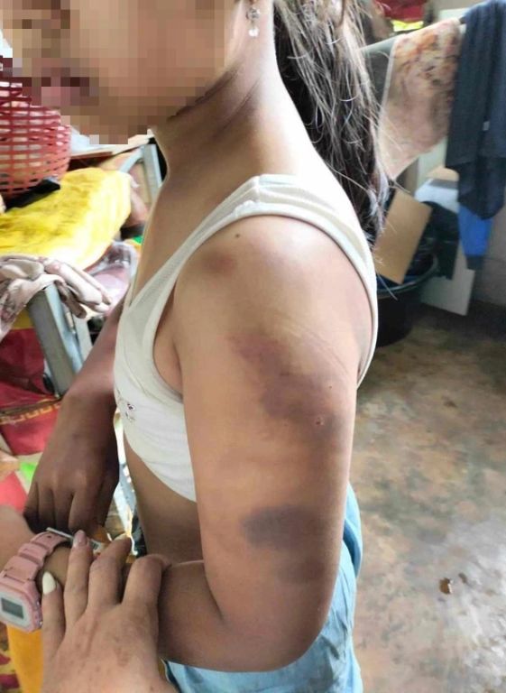 dak lak lam ro vu mot hoc sinh lop 4 bi 10 ban danh hoi dong phai nhap vien dak lak lam ro vu mot hoc sinh lop 4 bi 10 ban danh hoi dong phai nhap vien