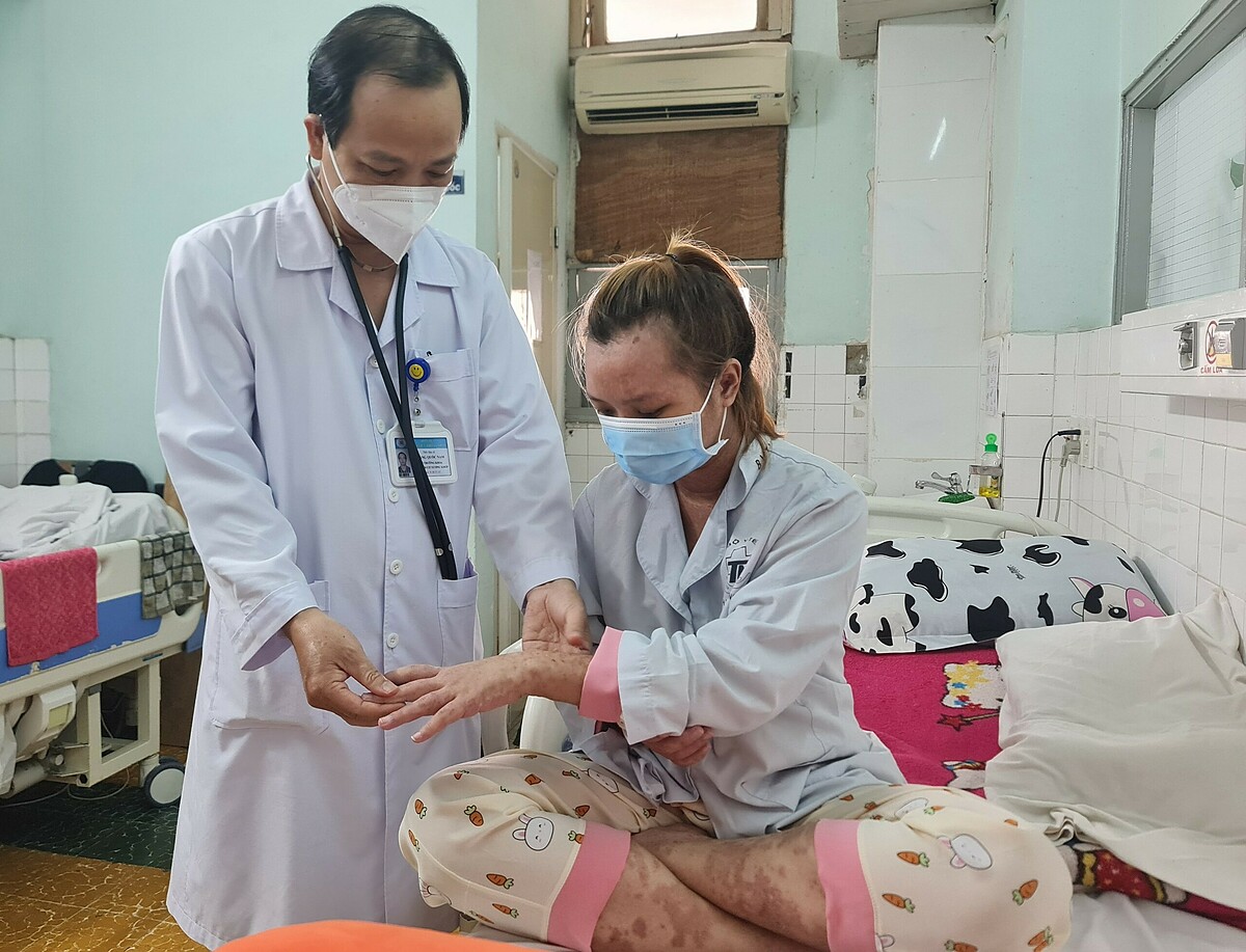 benh lupus ban do co nguy hiem khong bien chung va cach phong benh nhu the nao dspl6 benh lupus ban do co nguy hiem khong bien chung va cach phong benh nhu the nao dspl6