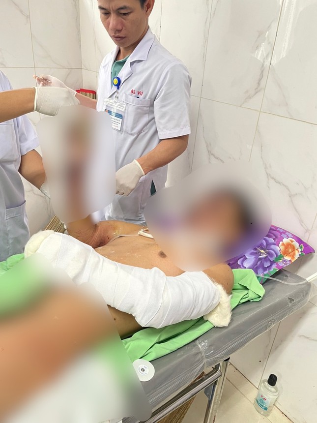 dak lak be trai 12 tuoi dap nat ban tay do che phao tren mang dan den phat no dak lak be trai 12 tuoi dap nat ban tay do che phao tren mang dan den phat no