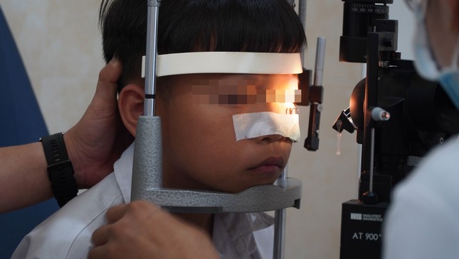 luoi cau moc vao mat be trai 11 tuoi khi dang choi dua