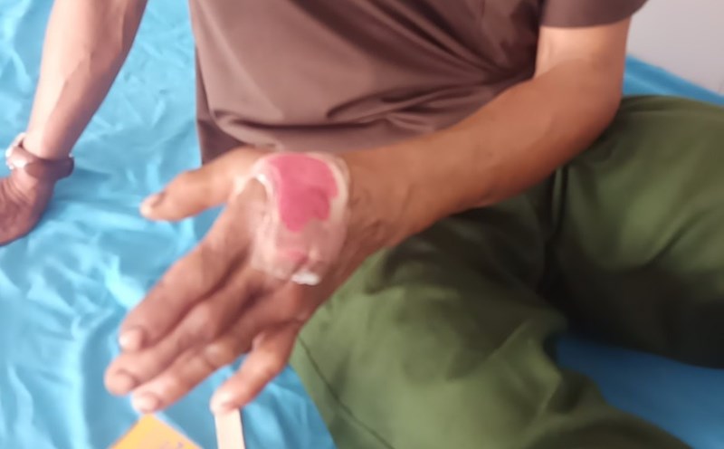 hau qua khon luong khi tu chua benh bang dap la cay thuoc nam khong ro nguon goc dspl3 hau qua khon luong khi tu chua benh bang dap la cay thuoc nam khong ro nguon goc dspl3