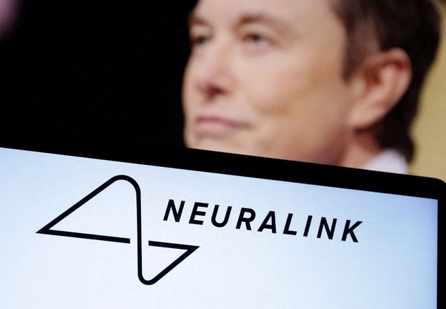 nguoi dau tien duoc cay chip vao nao tu cong ty cua elon musk nhu the nao nguoi dau tien duoc cay chip vao nao tu cong ty cua elon musk nhu the nao