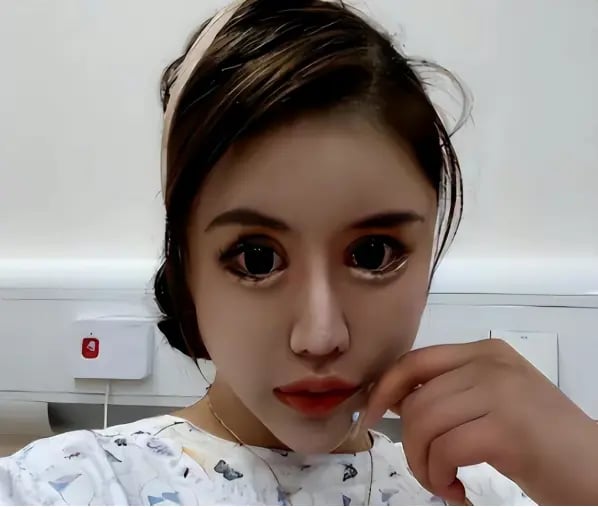 phau thuat qua do co gai nghien lam dep tu nam 13 tuoi hien tai hoi han nhung muon mang 3