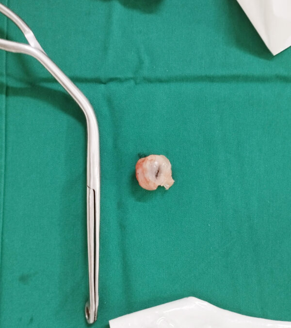 be 5 tuoi suy ho hap nang do hoc qua nhan dspl be 5 tuoi suy ho hap nang do hoc qua nhan dspl