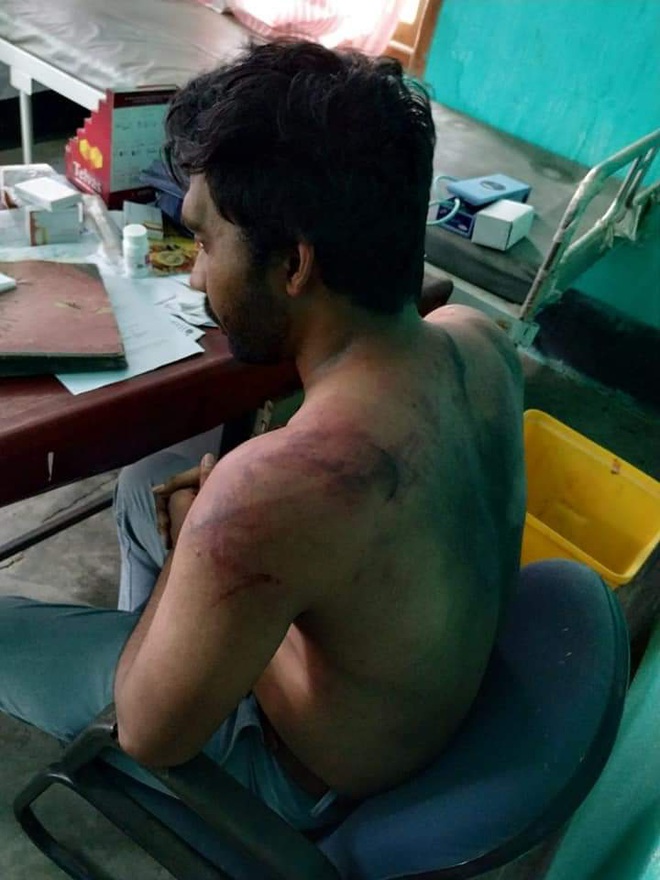bac si an do bi danh hoi dong sau khi benh nhan covid19 tu vongds bac si an do bi danh hoi dong sau khi benh nhan covid19 tu vongds
