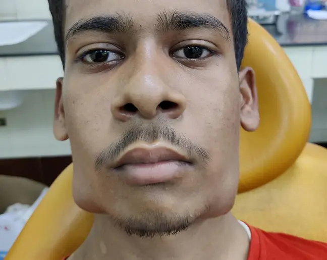 di vien kham vi mat bien dang chang trai bi nho mot phat 82 cai rang dspl di vien kham vi mat bien dang chang trai bi nho mot phat 82 cai rang dspl