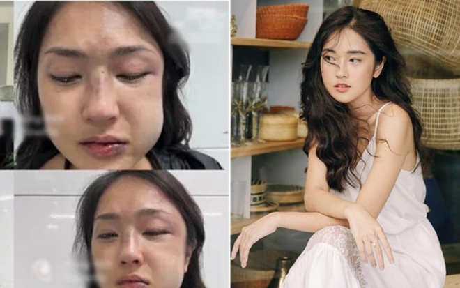 mc misoa kim anh bi nguoi yeu hanh hung yeu nhau sao lai dong tay dong chan dspl