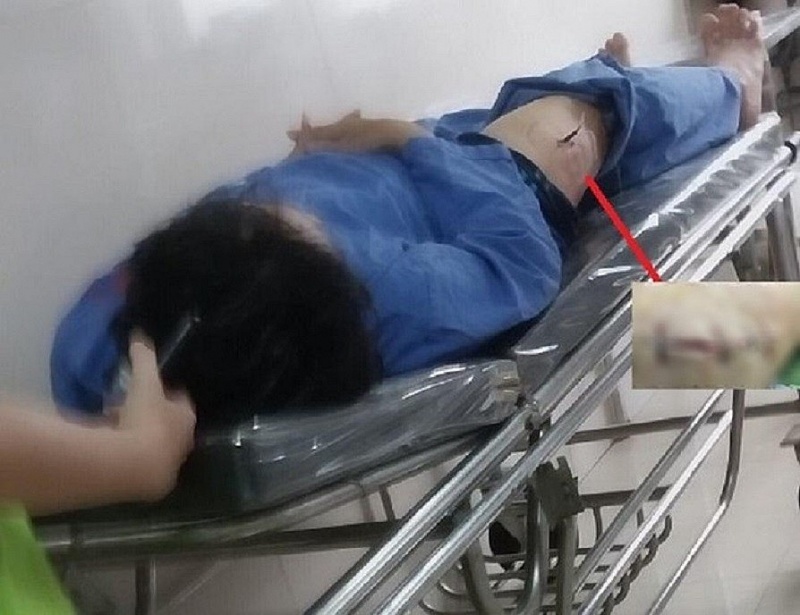 loi khai cua nghi pham dam can bo cuc thue ninh binh 1