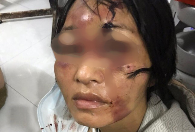 xot xa canh nguoi me om con gai day thuong tich chay tron khoi nhung tran don cua ga chong ho xot xa canh nguoi me om con gai day thuong tich chay tron khoi nhung tran don cua ga chong ho