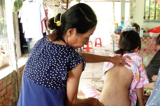 xot xa canh nguoi me om con gai day thuong tich chay tron khoi nhung tran don cua ga chong ho 1 xot xa canh nguoi me om con gai day thuong tich chay tron khoi nhung tran don cua ga chong ho 1